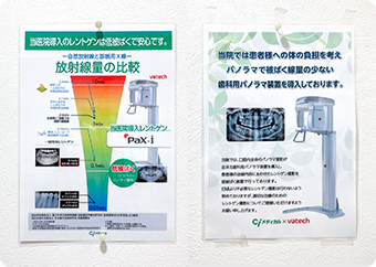 デジタルレントゲン