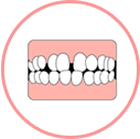 歯と歯の間にすき間がある